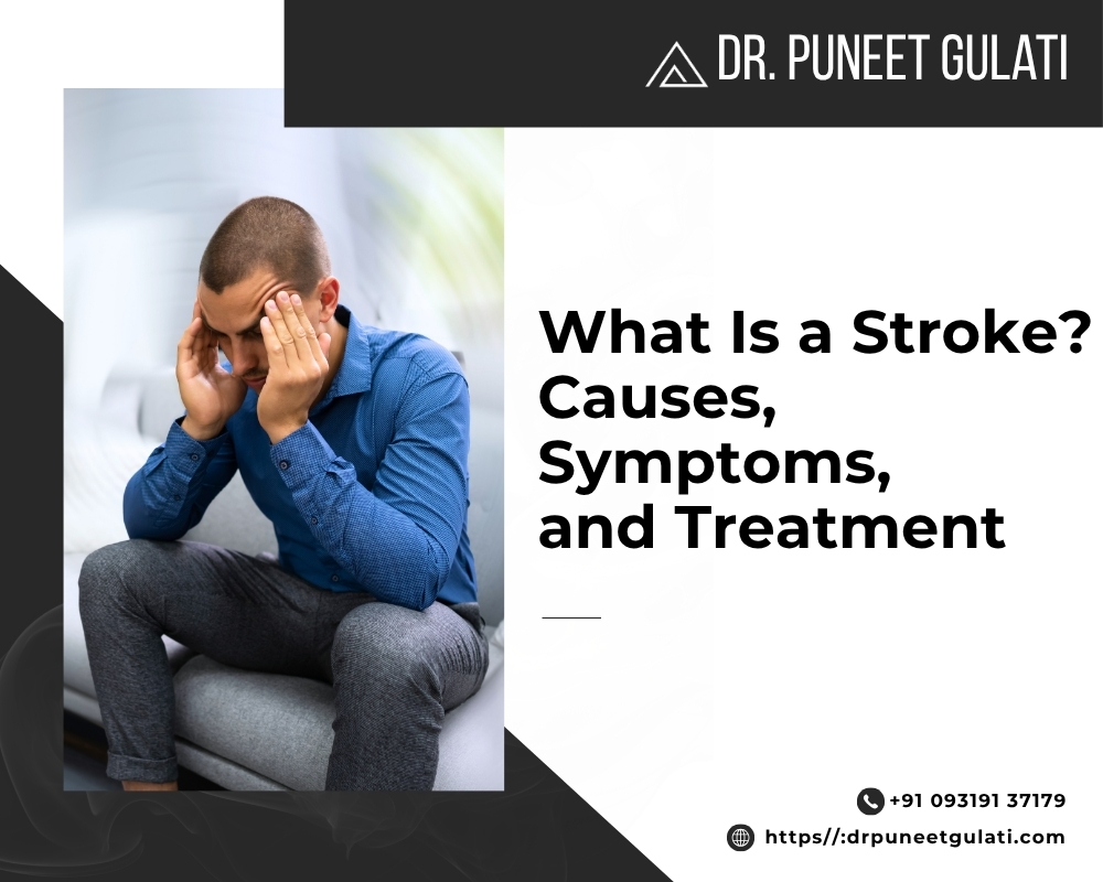 What Is a Stroke? Causes, Symptoms, and Treatment